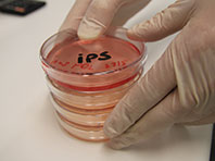 Доказано: пересаживать донорские iPS-клетки безопасно
