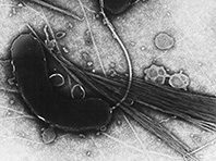 Открытие: холера не боялась пенициллина еще до изобретения антибиотиков