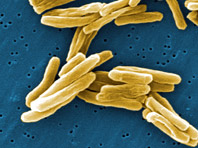 Отечественные химики подошли ближе к избавлению от туберкулеза 