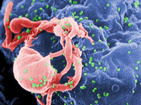 Эпидемиологи рассказали, как ведет себя ВИЧ во всем мире