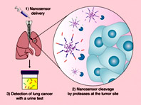 Анализ мочи, диагностирующий рак легких, заменит сканирование в компьютерном томографе