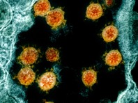 Ученые исследовали генеалогию коронавируса SARS-CoV-2