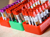 Новый тест находит скрыто развивающийся рак по крови человека