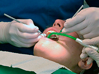 Российские ученые совершат настоящую стоматологическую революцию
