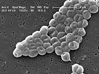 Биологи нащупали у супербактерий слабое место